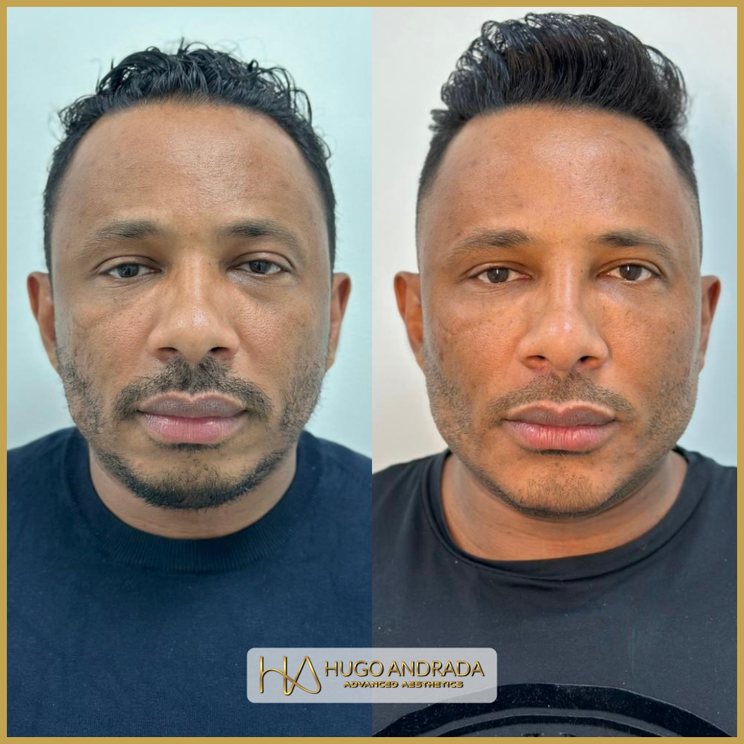 Marcelo Post 1